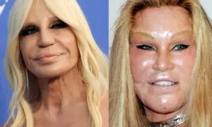 Donatella Versace i Jocelyn Wildenstein – które gwiazdy przeszły nieudane operacje plastyczne twarzy w Polsce?